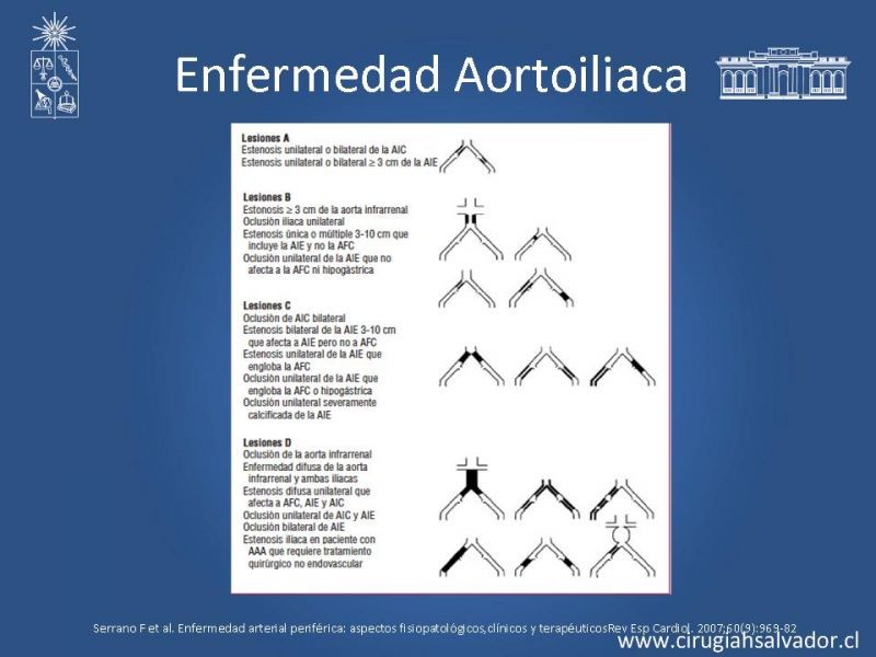Diapositiva 18 de Enfermedad Arterial Oclusiva Crónica (Tratamiento)