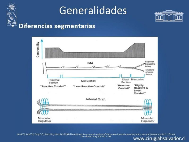 Diapositiva 12 de Revascularización miocárdica con puentes arteriales