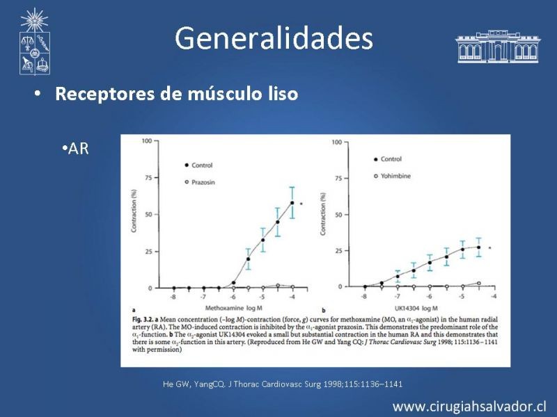 Diapositiva 10 de Revascularización miocárdica con puentes arteriales