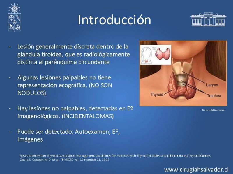 Diapositiva 1 de Nódulo Tiroideo