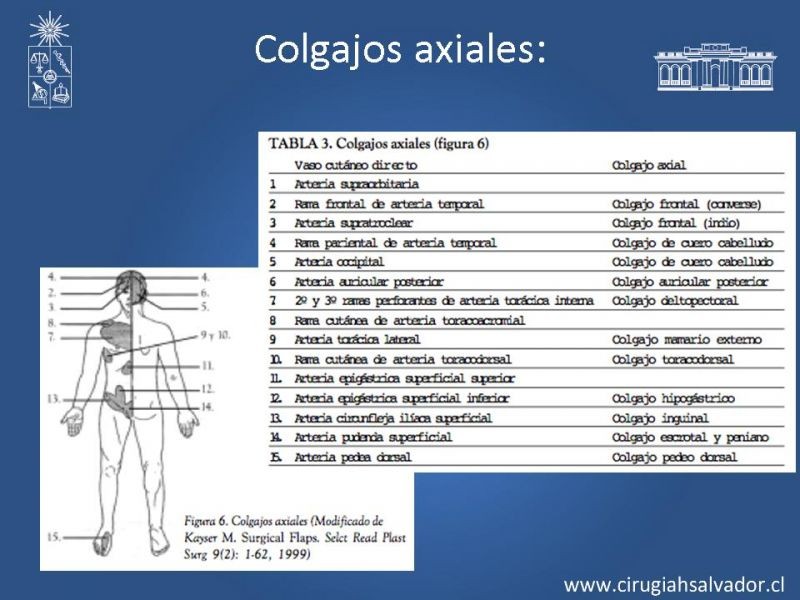 Diapositiva 9 de Colgajos