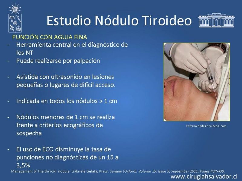 Diapositiva 13 de Nódulo Tiroideo