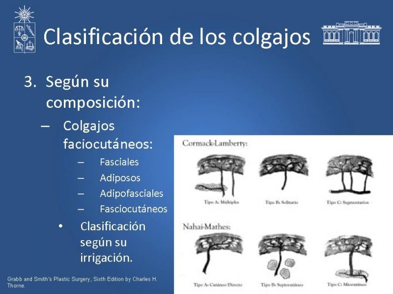 Diapositiva 19 de Colgajos
