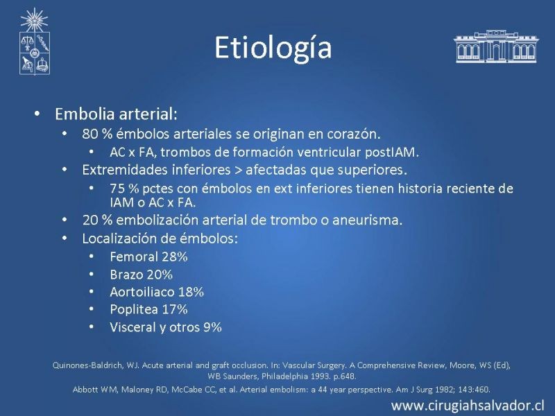 Diapositiva 4 de Isquemia aguda de extremidades