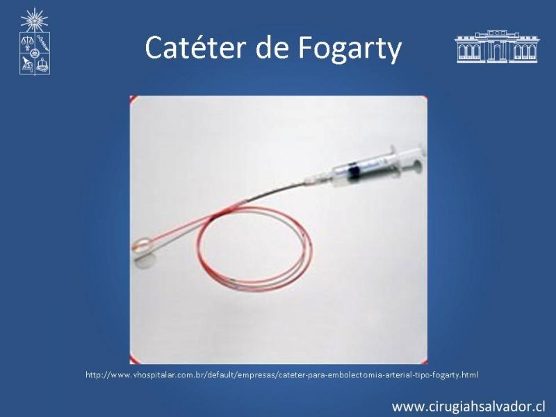 Diapositiva 20 de Isquemia aguda de extremidades