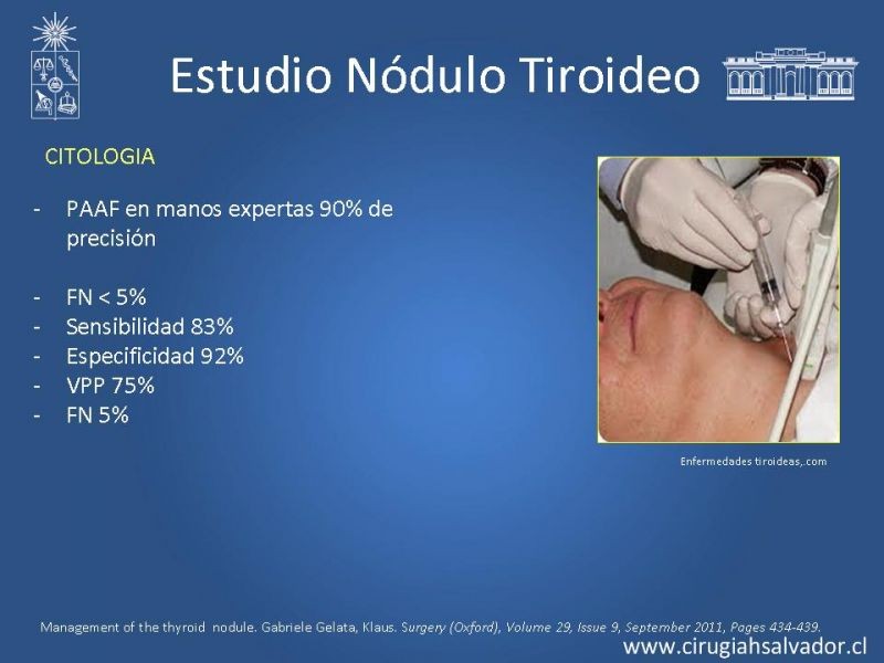 Diapositiva 14 de Nódulo Tiroideo