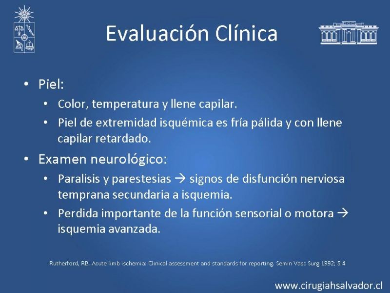 Diapositiva 9 de Isquemia aguda de extremidades