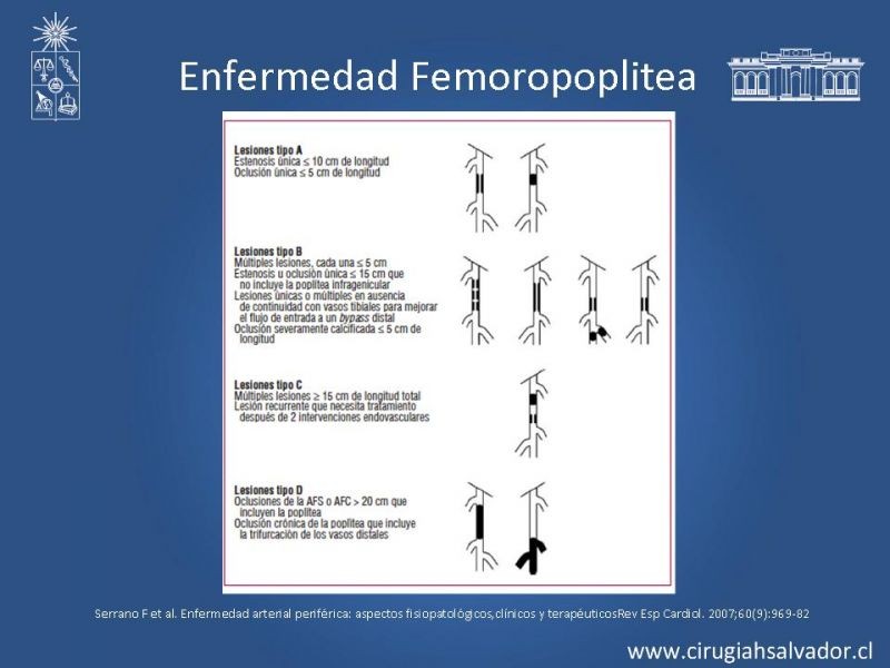 Diapositiva 26 de Enfermedad Arterial Oclusiva Crónica (Tratamiento)