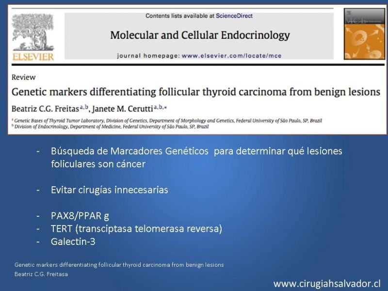 Diapositiva 18 de Nódulo Tiroideo