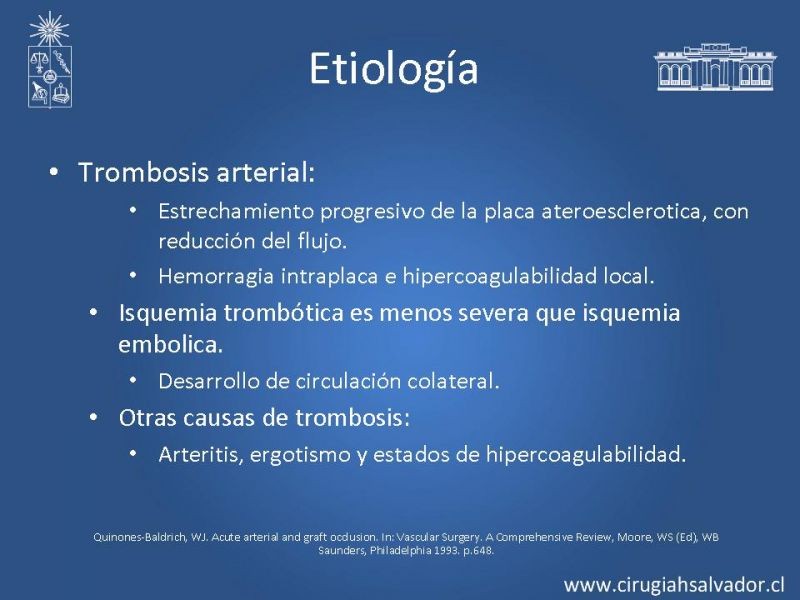 Diapositiva 5 de Isquemia aguda de extremidades