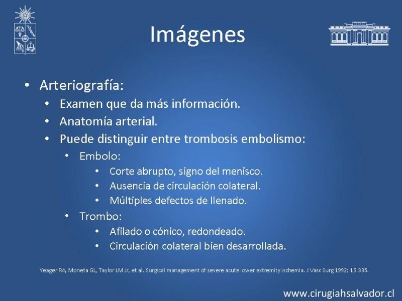Diapositiva 13 de Isquemia aguda de extremidades