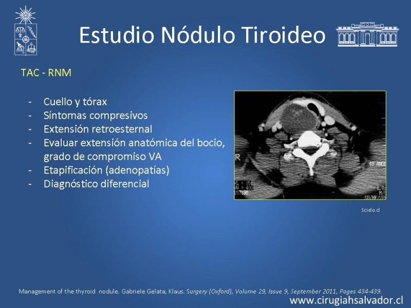 Diapositiva 12 de Nódulo Tiroideo