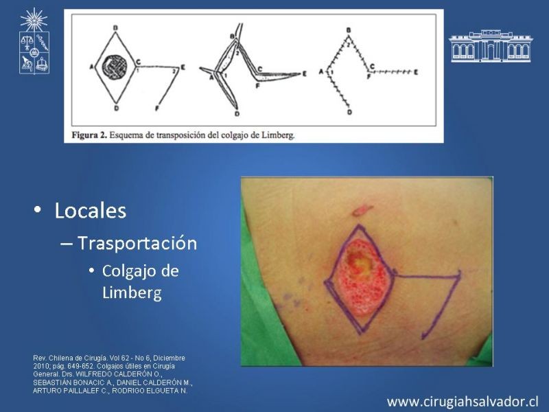 Diapositiva 14 de Colgajos