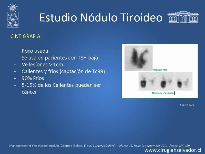 Diapositiva 11 de Nódulo Tiroideo