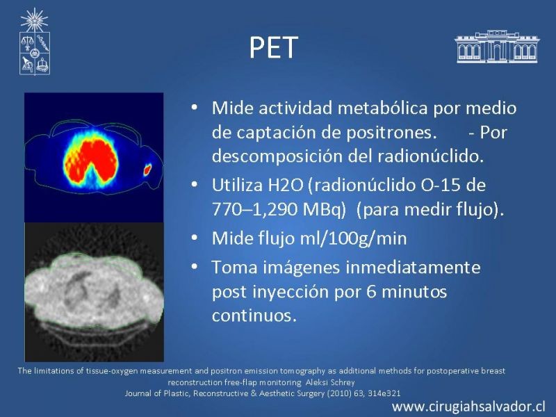 Diapositiva 36 de Monitoreo de Colgajos Libres Microvascularizados