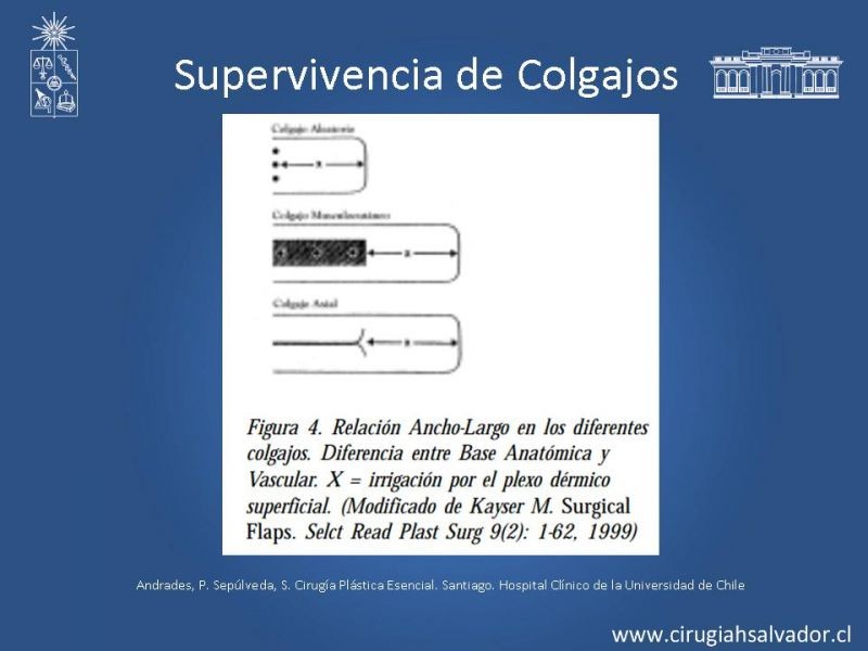 Diapositiva 49 de Colgajos: Generalidades