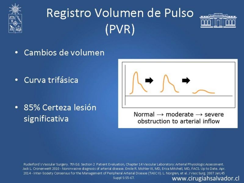 Diapositiva 7 de Laboratorio Vascular (Estudio no invasivo de la enf. Arterial periférica)