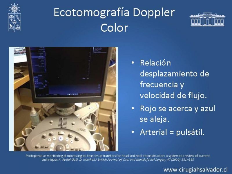 Diapositiva 24 de Monitoreo de Colgajos Libres Microvascularizados