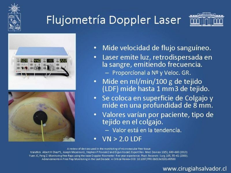 Diapositiva 28 de Monitoreo de Colgajos Libres Microvascularizados