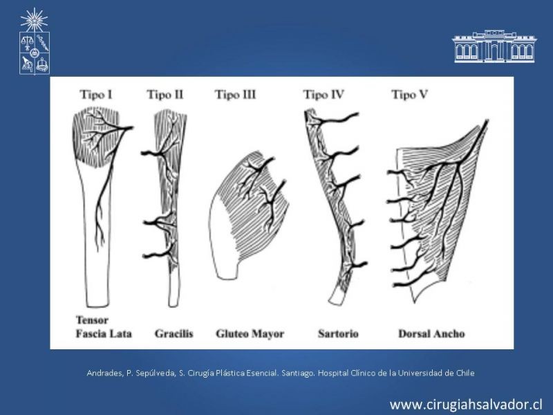 Diapositiva 45 de Colgajos: Generalidades