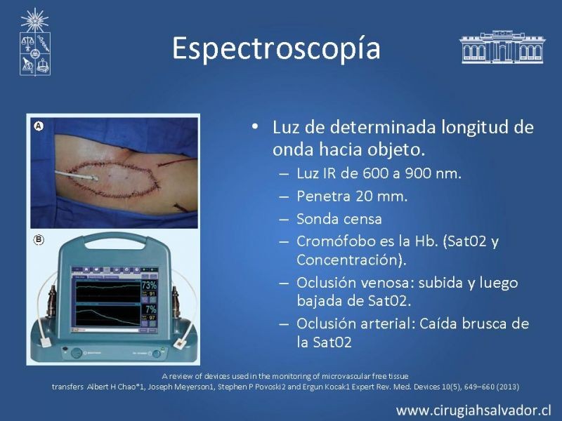 Diapositiva 30 de Monitoreo de Colgajos Libres Microvascularizados