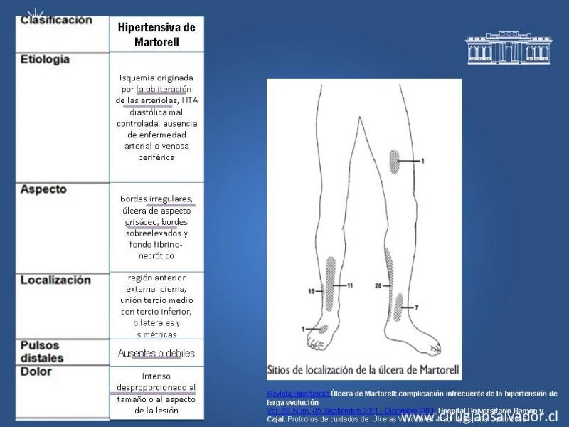 Diapositiva 4 de Manejo Ulceras EEII