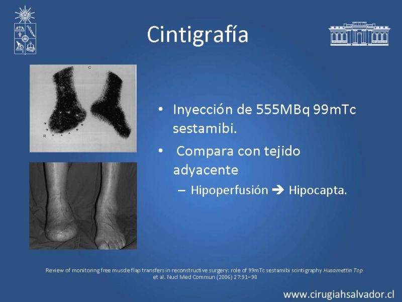 Diapositiva 34 de Monitoreo de Colgajos Libres Microvascularizados