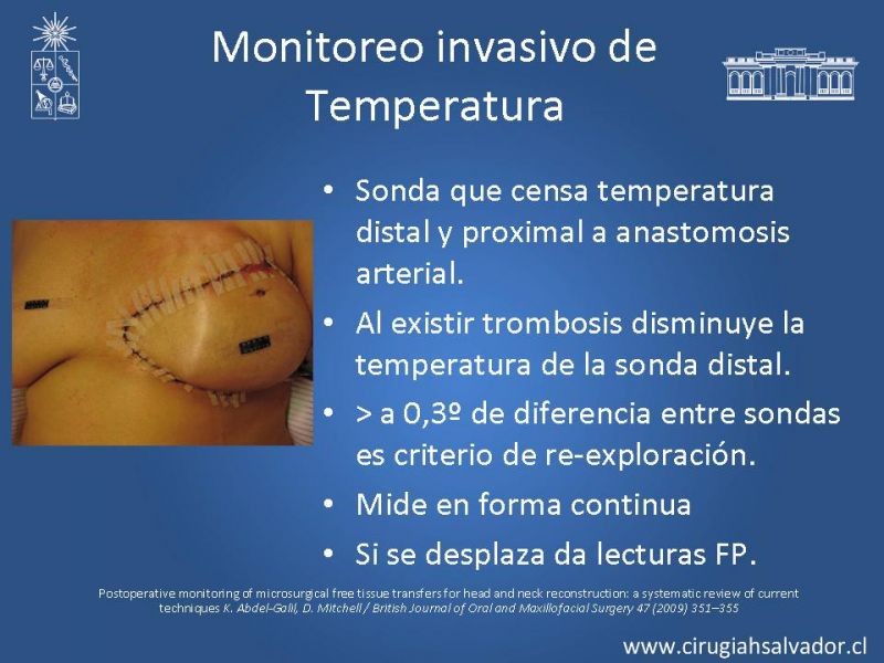 Diapositiva 39 de Monitoreo de Colgajos Libres Microvascularizados