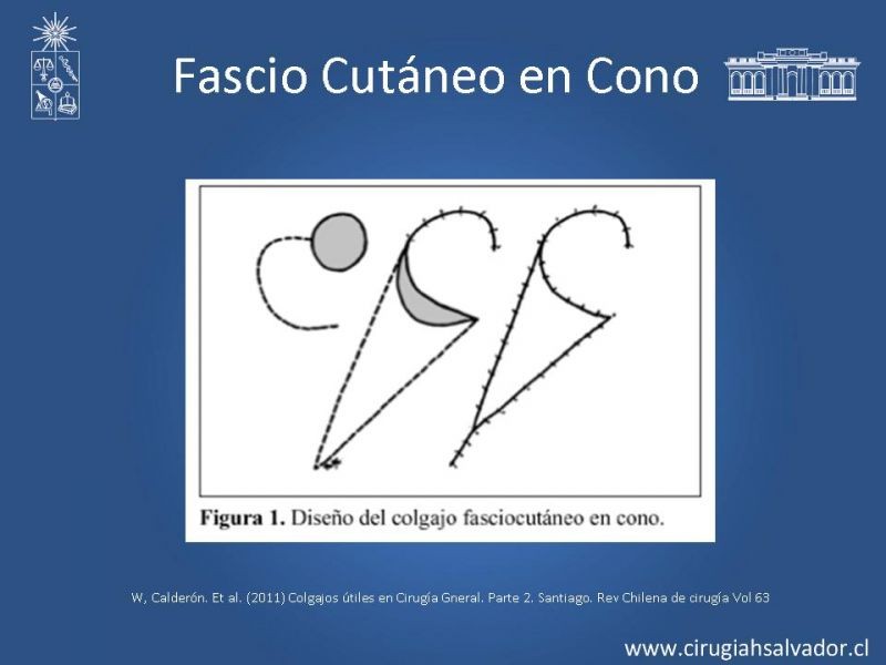 Diapositiva 28 de Colgajos: Generalidades