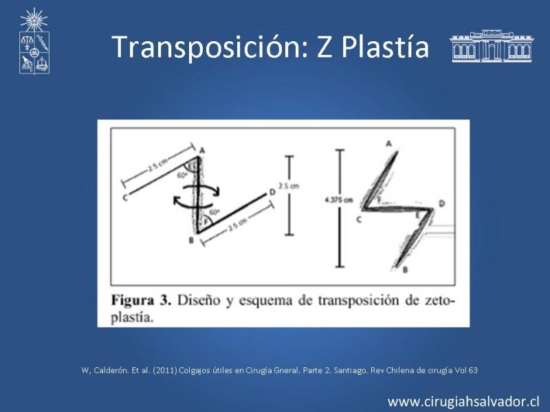 Diapositiva 31 de Colgajos: Generalidades