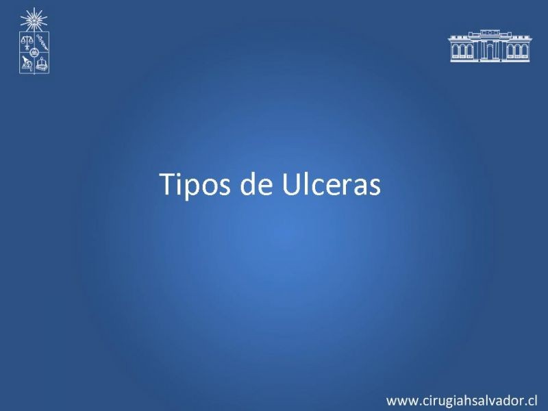 Diapositiva 6 de Manejo Ulceras EEII