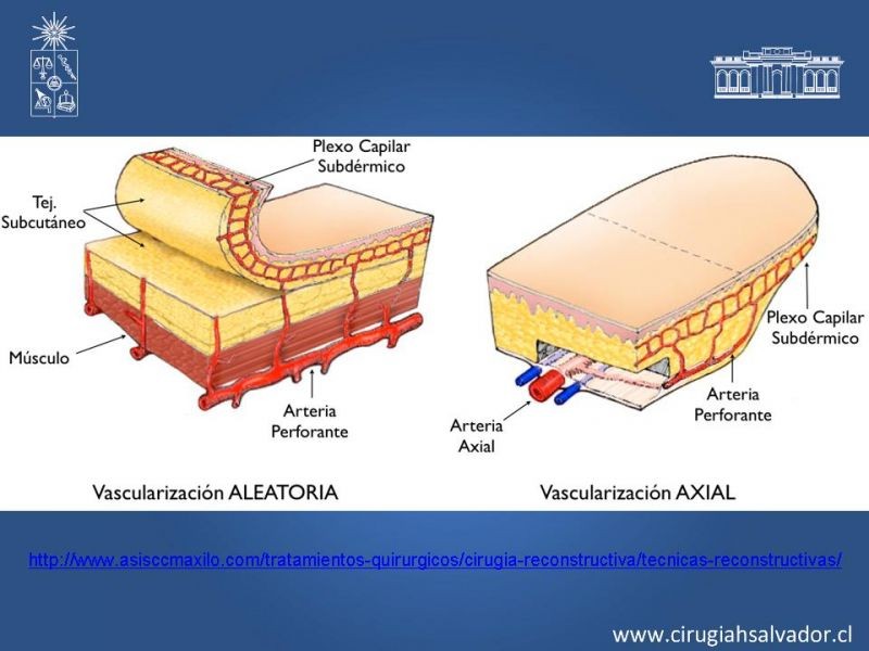 Diapositiva 13 de Colgajos: Generalidades