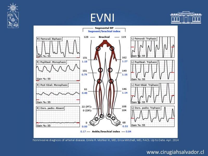 Diapositiva 9 de Laboratorio Vascular (Estudio no invasivo de la enf. Arterial periférica)