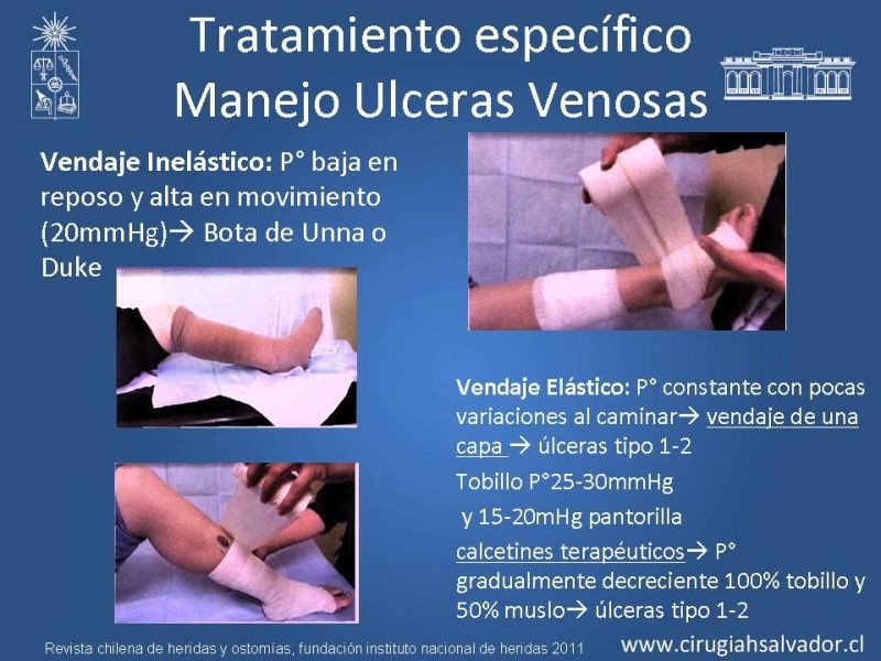 Diapositiva 27 de Manejo Ulceras EEII