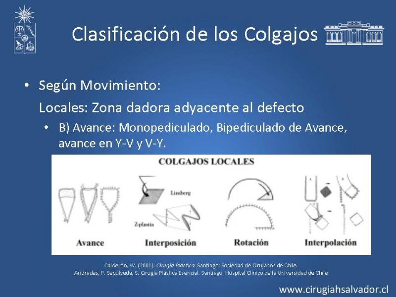 Diapositiva 16 de Colgajos: Generalidades