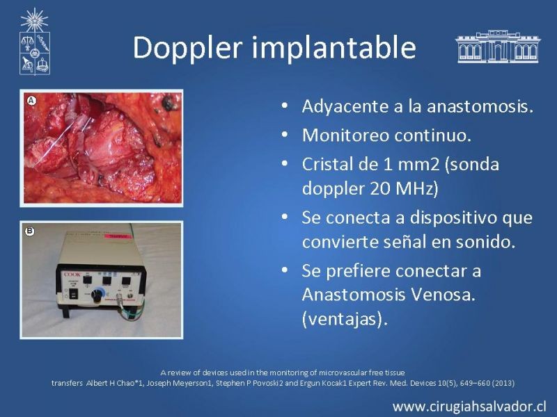 Diapositiva 44 de Monitoreo de Colgajos Libres Microvascularizados