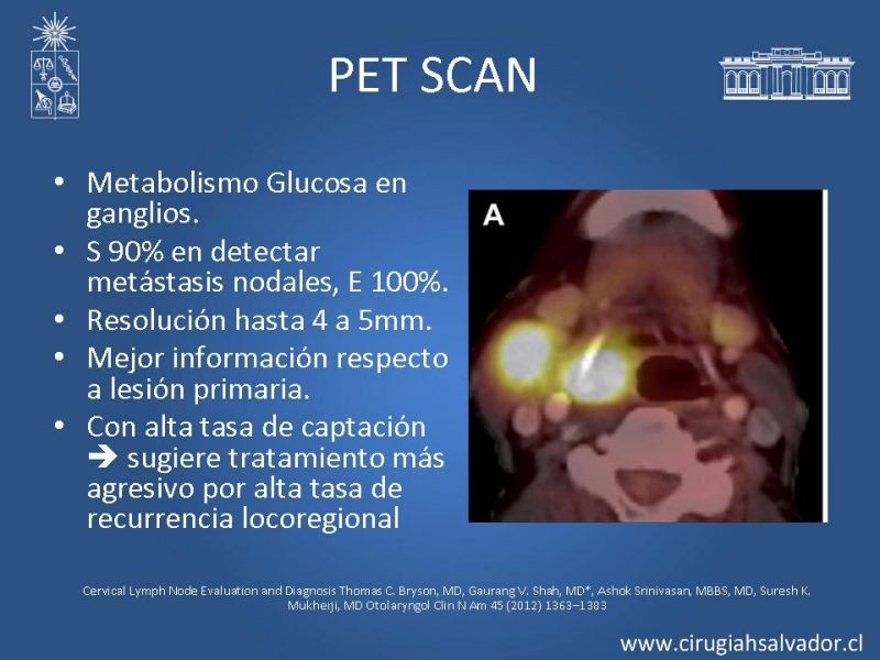 Diapositiva 19 de Adenopatía Cervical. Estudio y Manejo
