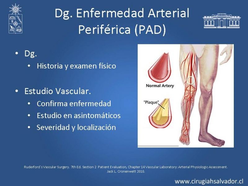 Diapositiva 1 de Laboratorio Vascular (Estudio no invasivo de la enf. Arterial periférica)