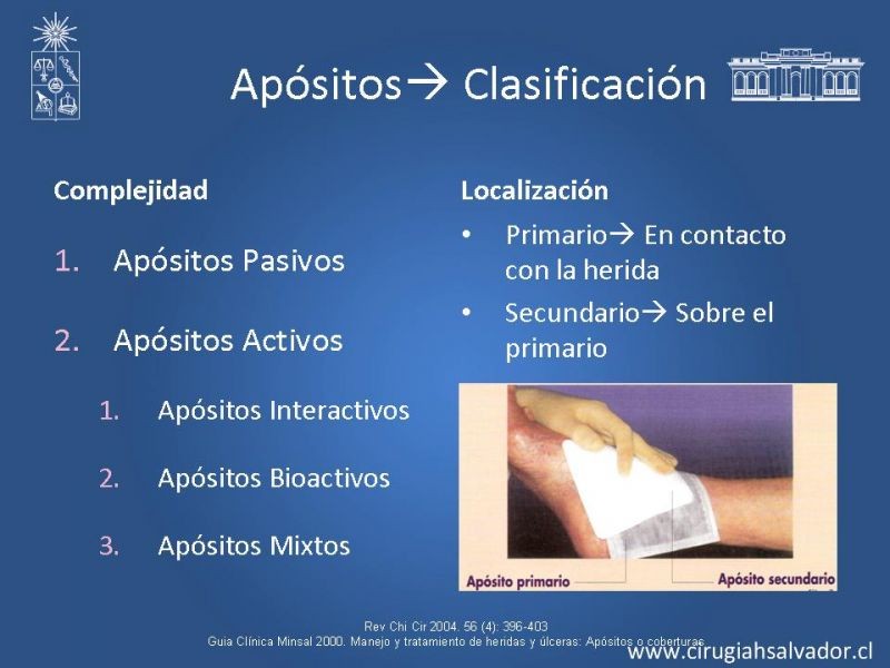 Diapositiva 21 de Manejo Ulceras EEII