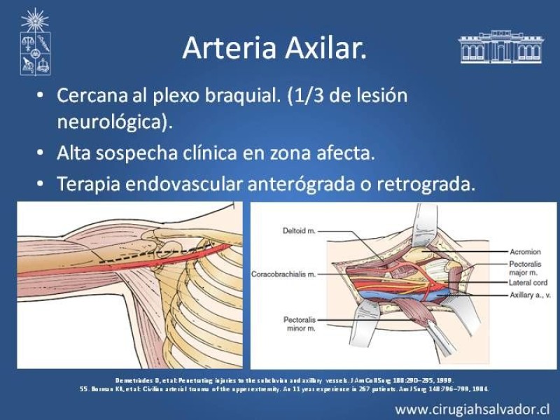Diapositiva 16 de Trauma Vascular: Extremidades
