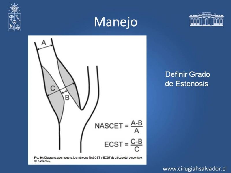 Diapositiva 14 de Estenosis Carotidea