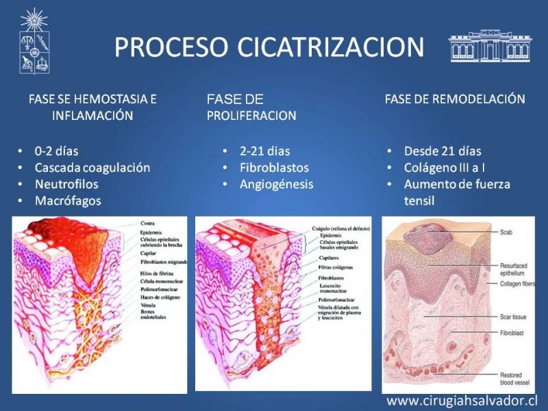 Diapositiva 6 de Curación avanzada de heridas
