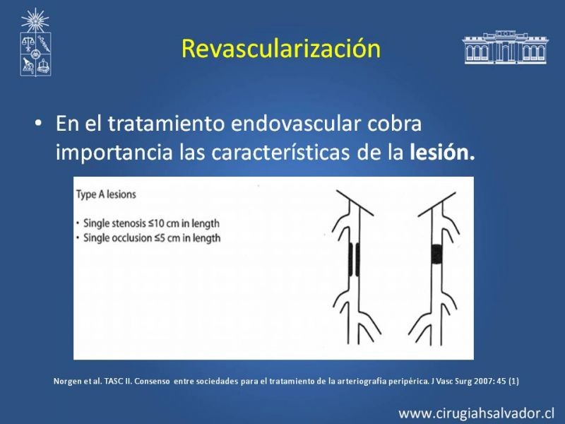 Diapositiva 6 de Tratamiento Endovascular: EAO femoro-distal