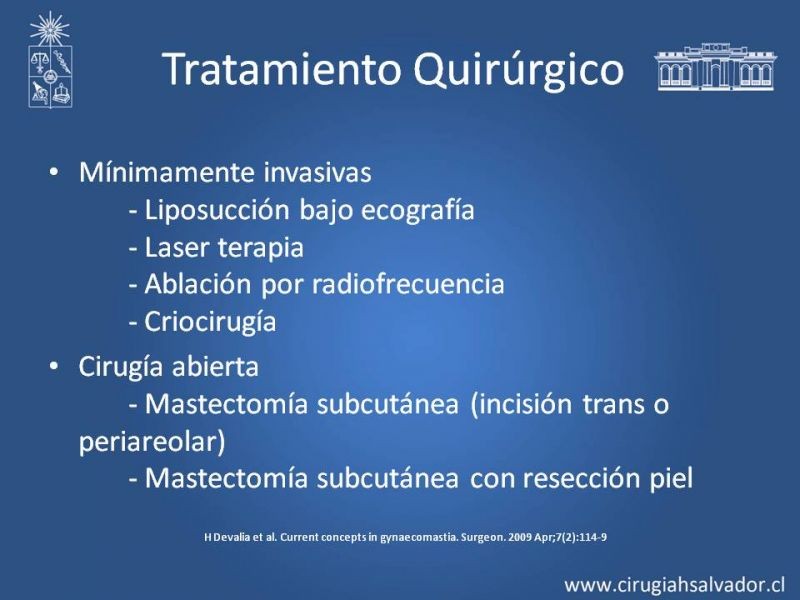 Diapositiva 18 de Ginecomastia