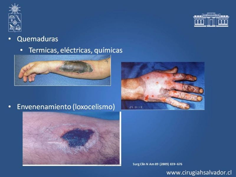 Diapositiva 5 de Curación avanzada de heridas