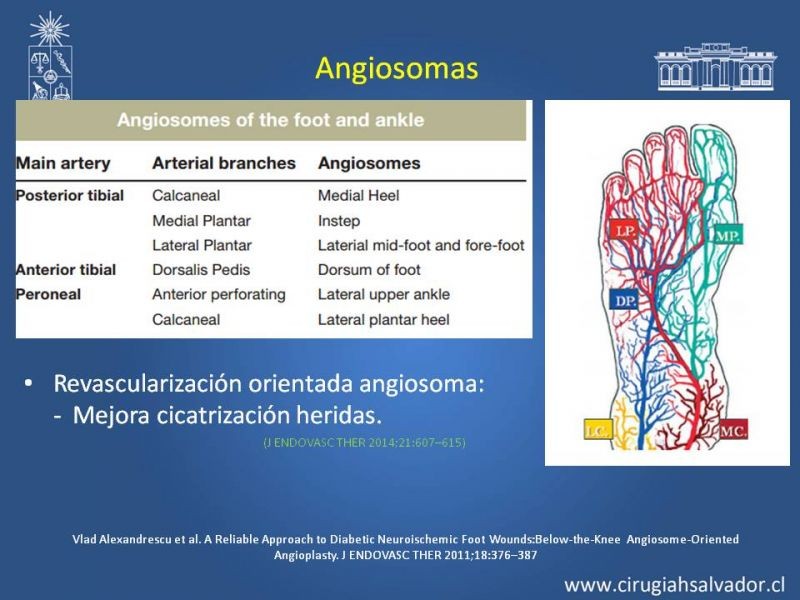 Diapositiva 10 de Tratamiento Endovascular: EAO femoro-distal