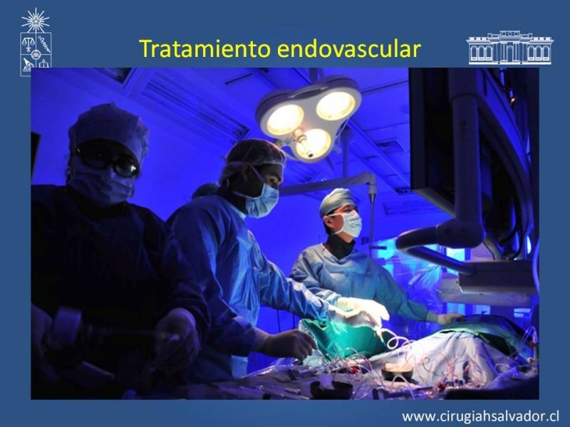 Diapositiva 11 de Tratamiento Endovascular: EAO femoro-distal