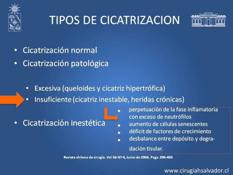 Diapositiva 8 de Curación avanzada de heridas