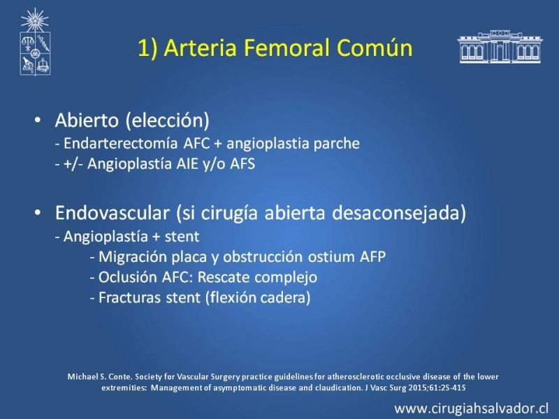 Diapositiva 15 de Tratamiento Endovascular: EAO femoro-distal