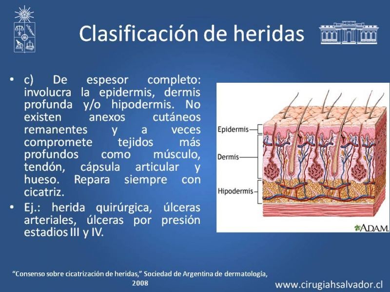Diapositiva 3 de Curación avanzada de heridas